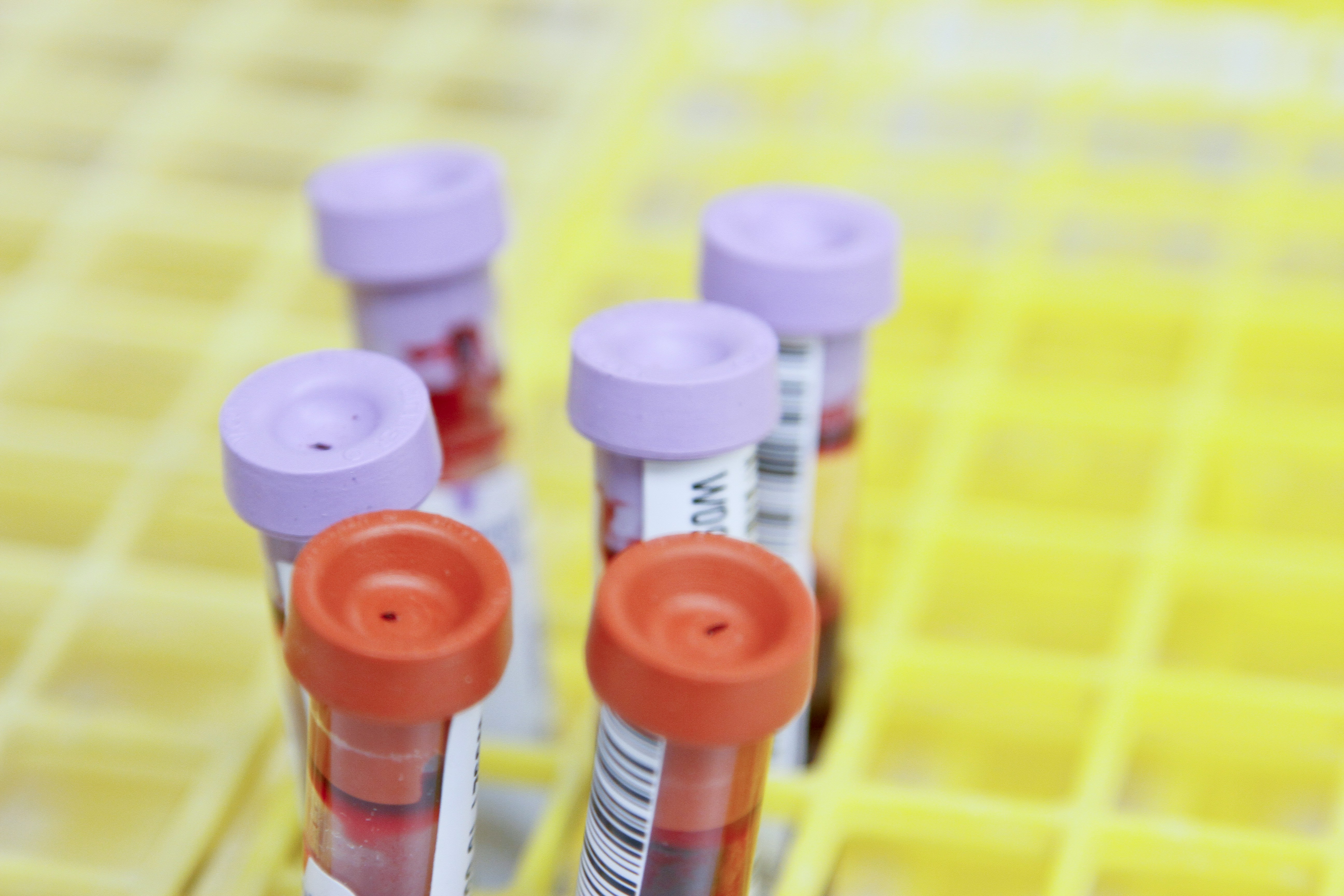 provette analisi del sangue